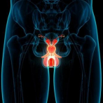 ¿Qué es el cáncer de próstata, la enfermedad que padece Danilo Medina?