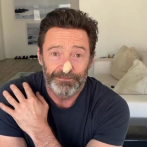 Hugh Jackman da negativo a cáncer de piel