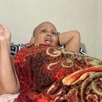 Mujer con tumor cancerígeno pide ayuda para costear medicamentos