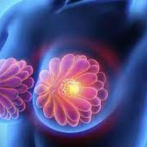 Estudia revela que las células pueden reprogramarse para combatir el cáncer de mama