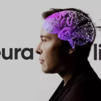 ¿Qué implica el chip cerebral de Neuralink en la carrera por la neurotecnología?