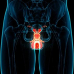 El cáncer de próstata es el segundo más común en República Dominicana