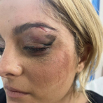 Bebe Rexha recibió tres puntos de sutura tras ser golpeada con celular en pleno escenario