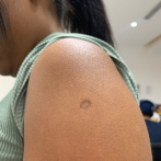 Tu brazo izquierdo tiene la marca de una vacuna... ¿sabes por qué?