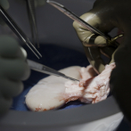 El riñón de cerdo funciona en un cuerpo donado durante más de un mes