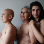 Una de cada 12 mujeres en el mundo desarrollará cáncer de mama en algún momento