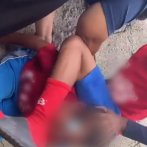 Autoridades investigan caso de menor golpeado por otros niños en Santiago
