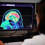 Optimismo tras cura de tumor cerebral de niño