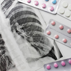 Especialistas advierten: diabetes agrava tuberculosis y duplica riesgo de muerte