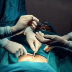 Cirujanos estéticos sin aval siguen causando complicaciones a pacientes