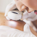 El 40% de las biopsias de piel pueden ser malignas