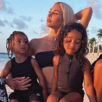 Kim Kardashian revela que uno de sus hijos tiene vitiligo