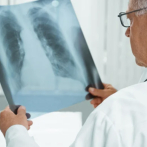 El país ha registrado 302 casos de tuberculosis este año