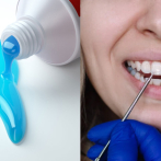 El desafío de la enseñanza sobre fluoruros en el ámbito en la odontología