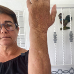 Mujer agredida a machetazos teme por su vida porque agresor vive al lado de su casa