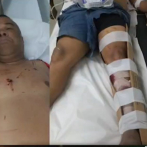 Moradores de Invivienda califican como abusiva acción policial contra mayor de la PN Alberto Matos