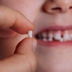 “No es solo un diente de leche”: lo que muchos no saben sobre los dientes temporales