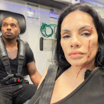 Influencers gastronómicos sufren lesiones tras choque de vehículo mientras comían en un restaurante