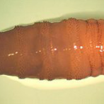 Detectan el primer caso del gusano barrenador en humanos en Estados Unidos