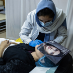 Las cirugías estéticas están de moda en Afganistán