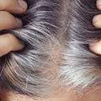 ¿Sabes por qué a la gente joven le salen canas?