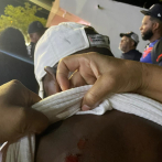 Villa Vásquez: Intervenciones policiales en centros de diversión provocan tensión