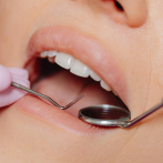 Advierten aumento del riesgo de enfermedad de las encías en pacientes con depresión