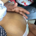 La niña Jaronny Rodríguez necesita trasplante de hígado urgente