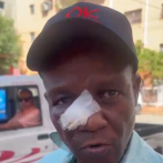 Profesor agredido por estudiantes afirma que tiene la nariz fracturada