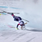 Vonn dice que una cirugía evitó que le amputaran la pierna izquierda