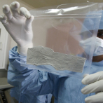 República Dominicana tendrá banco de piel y tejidos humanos