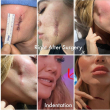 Khloé Kardashian quedó con hendidura en la mejilla tras extirparse melanoma