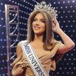 La representante de Ecuador en el Miss Universo 2024 tiene que usar pelucas por rara enfermedad