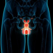 Los hombres altos y los obesos tienen mayor riesgo de padecer cáncer de próstata