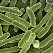 Científicos identifican la bacteria responsable de la alarmante muerte de esponjas marinas
