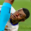 Kylian Mbappé sale con golpe en la nariz y Francia derrota 1-0 a Austria en la Eurocopa