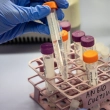Científicos desarrollan terapia génica para prevenir el alzhéimer