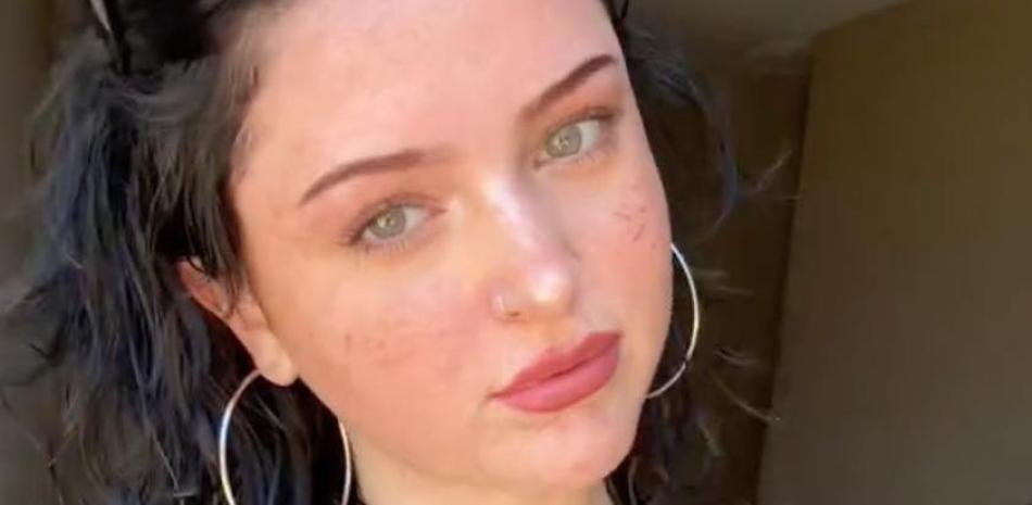 Muere la tiktoker Renna O’Rourke a los 19 años, tras inhalar aerosol ...