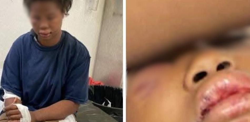 Así fue localizada la joven, tras ser raptada y golpeada por su expareja