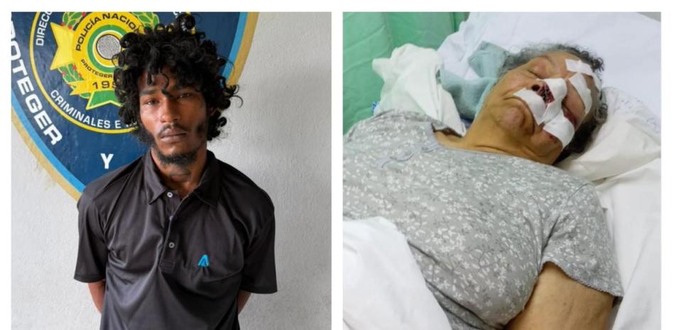 Arrestan indigente que lanzaba piedras en Las Américas e hirió señora de 79 años