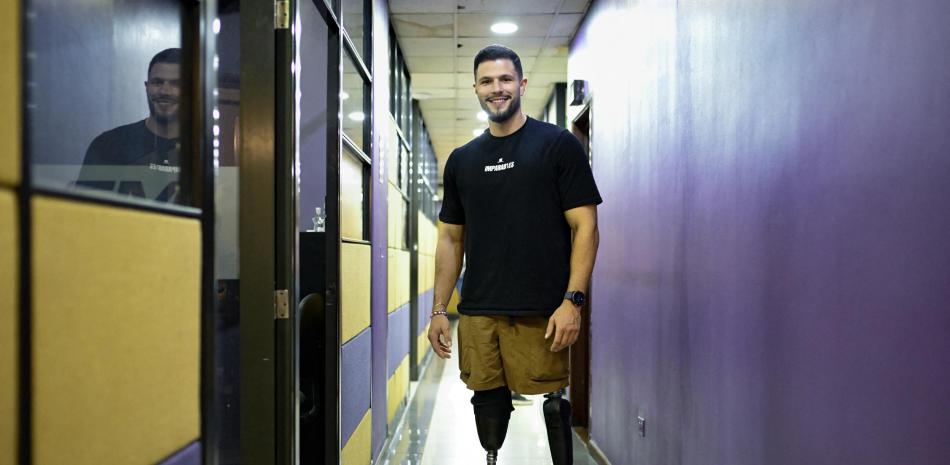Después de una amputación por sismos en Venezuela, sobrevivir y empezar de cero