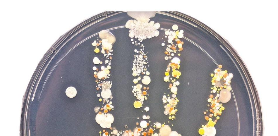 Huella. Impresión de las colonias bacterianas en un plato con TSA de la mano del hijo de Sturm tras jugar en el jardín.