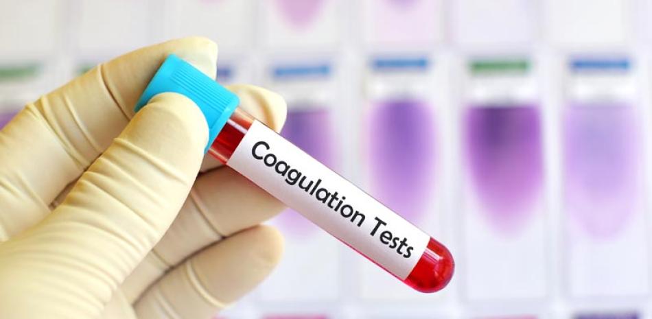 Condición. Los hemofílicos deben disponer de un laboratorio con capacidad para hacer pruebas de coagulación, porque el tratamiento va a depender de la severidad del sangrado, del nivel del factor y de la presencia o no de inhibidores.