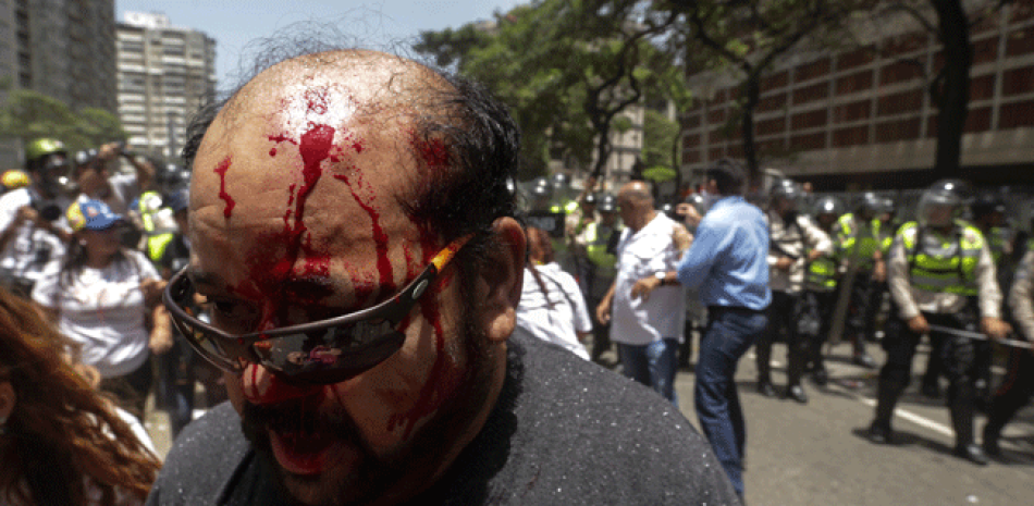 Un hombre sale herido durante una manifestación disuelta por miembros de la Policía Nacional Bolivariana, martes 4 de abril de 2017, que intentaba marchar hacia el Parlamento en apoyo a la destitución de los magistrados del Supremo, en Caracas (Venezuela).