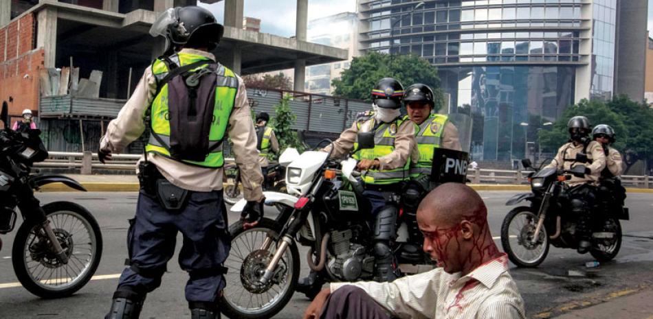 Herido. Vista de un hombre herido junto a miembros de la Guardia Nacional Bolivariana ayer en Caracas.