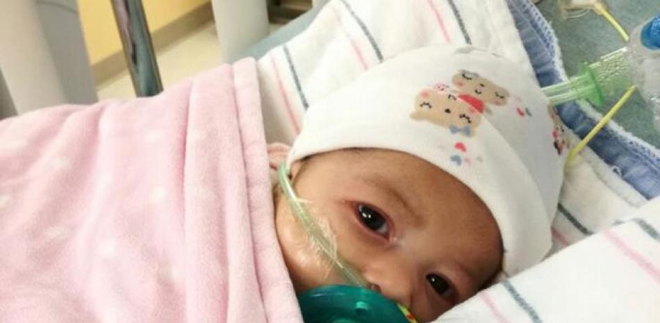 Boston. La bebé Astrid Montero Gómez ya fue operada con éxito.