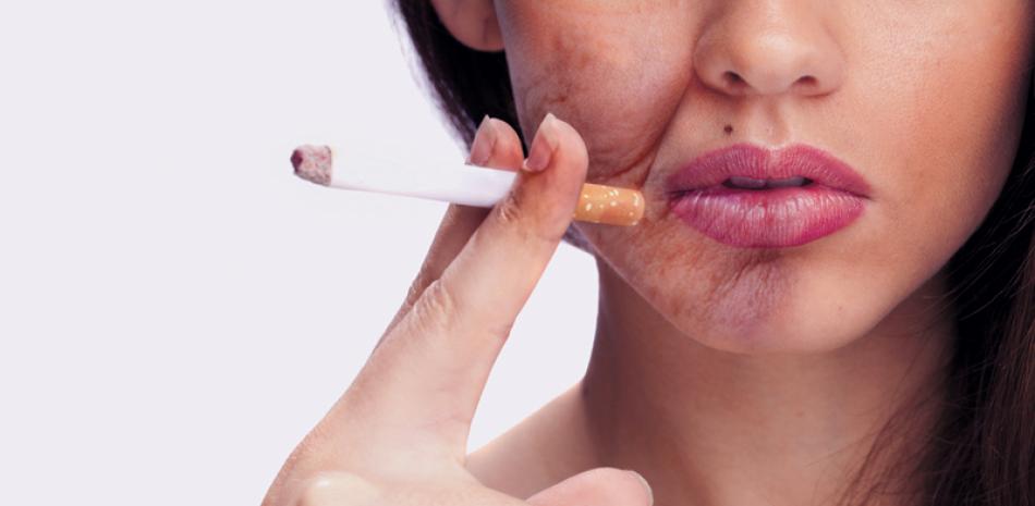 Efecto externo. El tabaco no solo causa efectos negativos a la salud interna de la boca, sus consecuencias se reflejan en la dentadura causándole manchas.