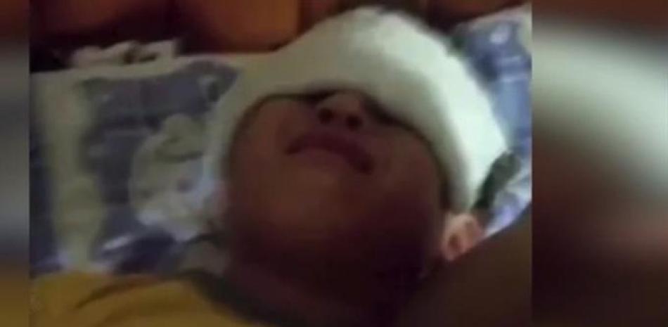 Niños afectados por rayos UV en China. Foto: Captura de pantalla a video de Youtube.