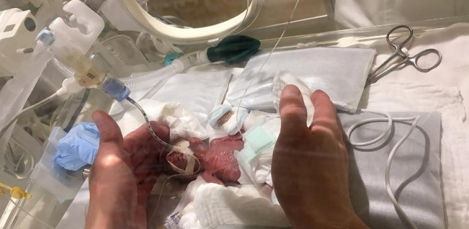 Después de cinco meses de tratamiento, el bebé ahora pesa 3.238 kilos, está amamantando normalmente y ha sido dado de alta, convirtiendose en el niño recién nacido más pequeño del mundo en salir del hospital de manera segura.