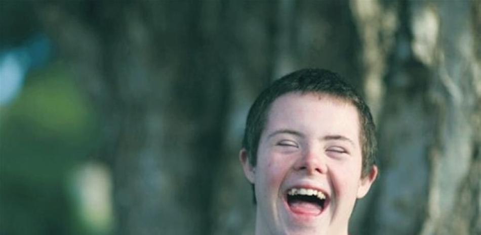 Niño con Síndrome de Down. Imagen de archivo.